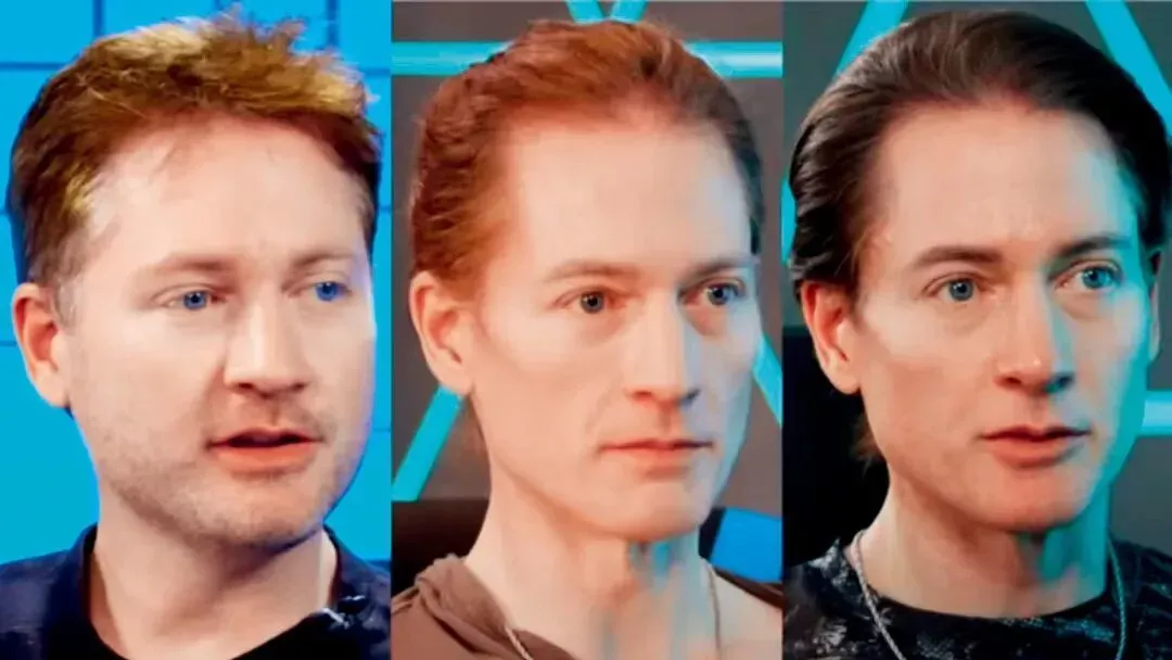 上图：进行脸部脂肪转移后，布莱恩·约翰逊出现了严重过敏反应。