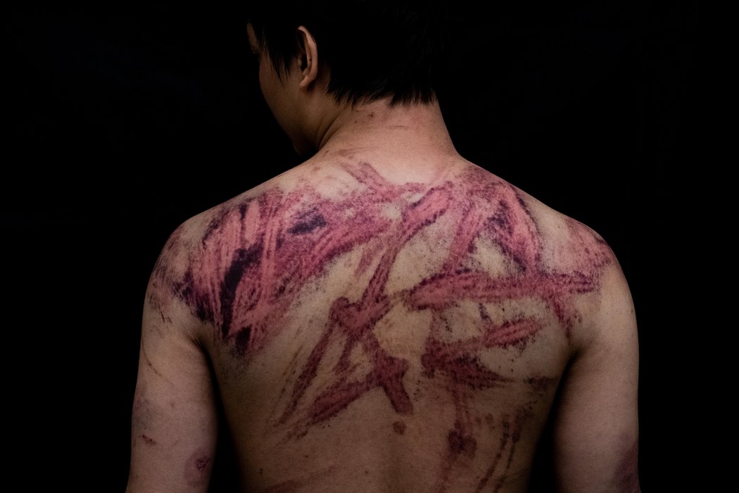 厨师卡尔文·苏说,在被一群暴徒袭击时,他正在元朗一处抗议活动地点附近行走。